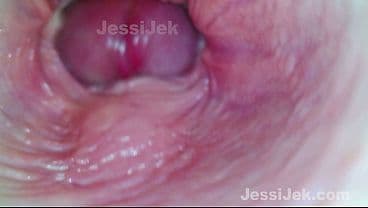 Dream babe got Twice Creampie  Endoscope inside...